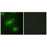 TNFSF13 Antibody