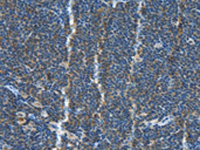 TNFSF13B antibody