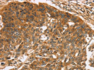TNFSF15 Antibody