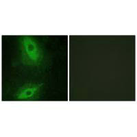 TNFSF15 antibody