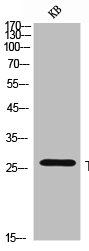 TNFSF8 antibody