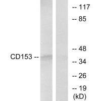 TNFSF8 antibody