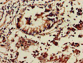 TNIK Antibody