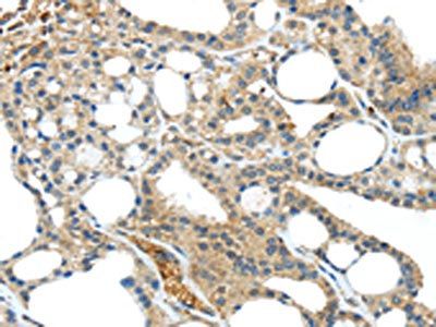 TNIP1 Antibody