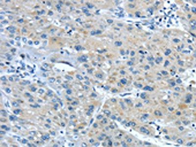 TNIP1 Antibody