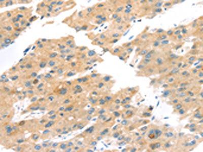 TNK1 Antibody
