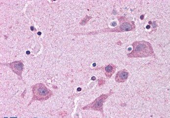 Goat anti-TAB182 Antibody