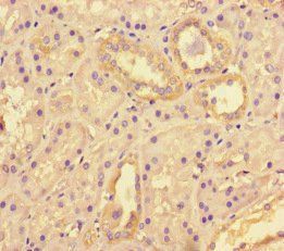 TNKS2 Antibody