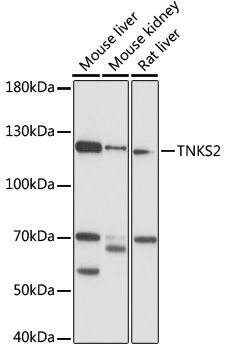 TNKS2 antibody