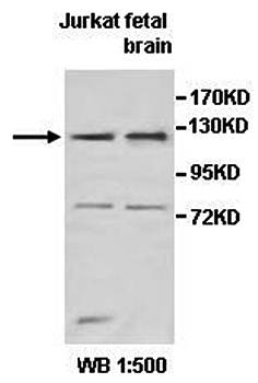 TNKS2 antibody