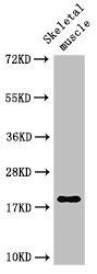 TNNC1 antibody