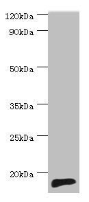 TNNC2 Antibody