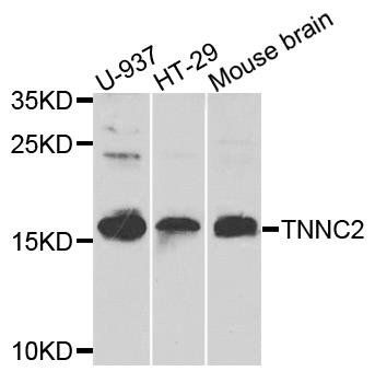 TNNC2 antibody