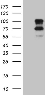 TNNI1 antibody