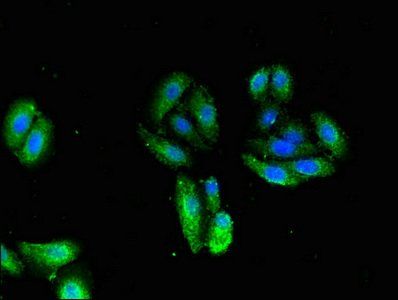 TNNI1 Antibody