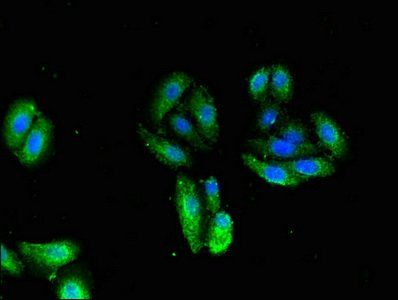 TNNI1 antibody