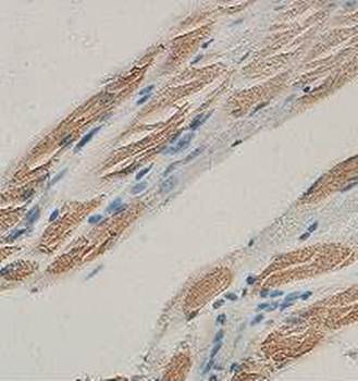 TNNI2 antibody