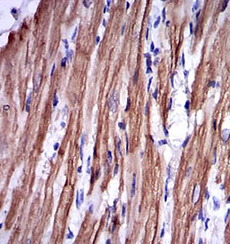 TNNI2 Antibody