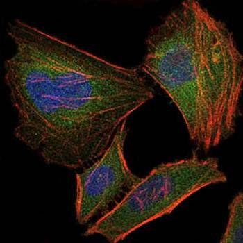 TNNI2 Antibody