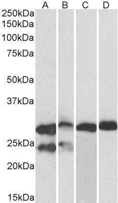 Goat anti-TNNI3 (aa117-127) Antibody