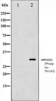 TNNI3 (Phospho-Thr142) antibody