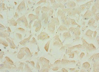 TNNI3K Antibody