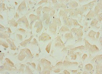 TNNI3K antibody