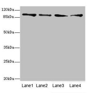 TNNI3K Antibody