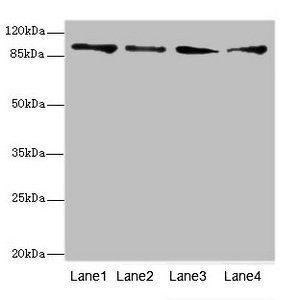 TNNI3K antibody