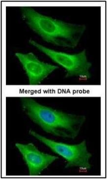 TNNI3K antibody