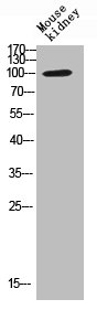 TNNI3K antibody