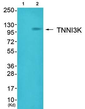 TNNI3K antibody