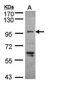 TNNI3K antibody