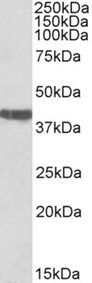 Goat anti-cardiac troponin T Antibody
