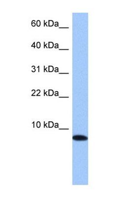 TNP1 antibody