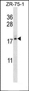 TNP2 antibody