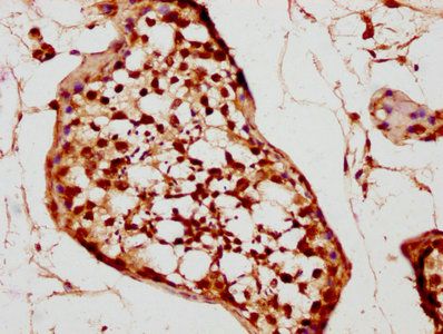 TNP2 antibody