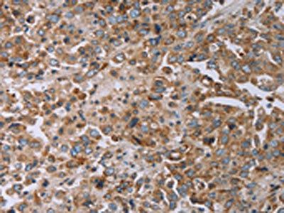 TNPO1 antibody