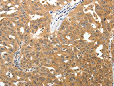 TNR Antibody