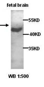 TNFRSF19 Rabbit Polyclonal Antibody