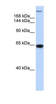 TNRC6A antibody