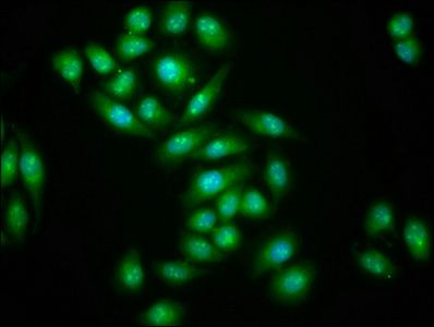 TNRC6B Antibody