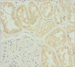 TNS3 Antibody