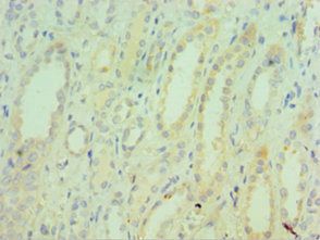 TNXB Antibody