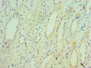 TNXB antibody