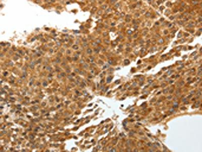 TNXB Antibody