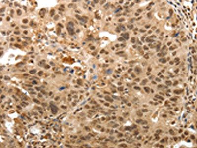 TNXB Antibody