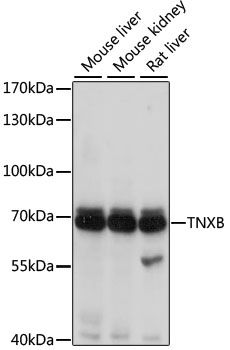 TNXB antibody