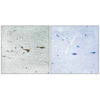 TOB1 (Ab-164) Antibody