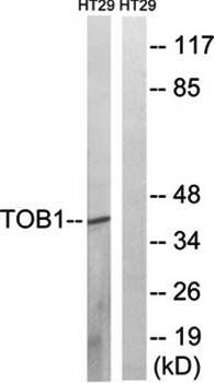 TOB1 antibody